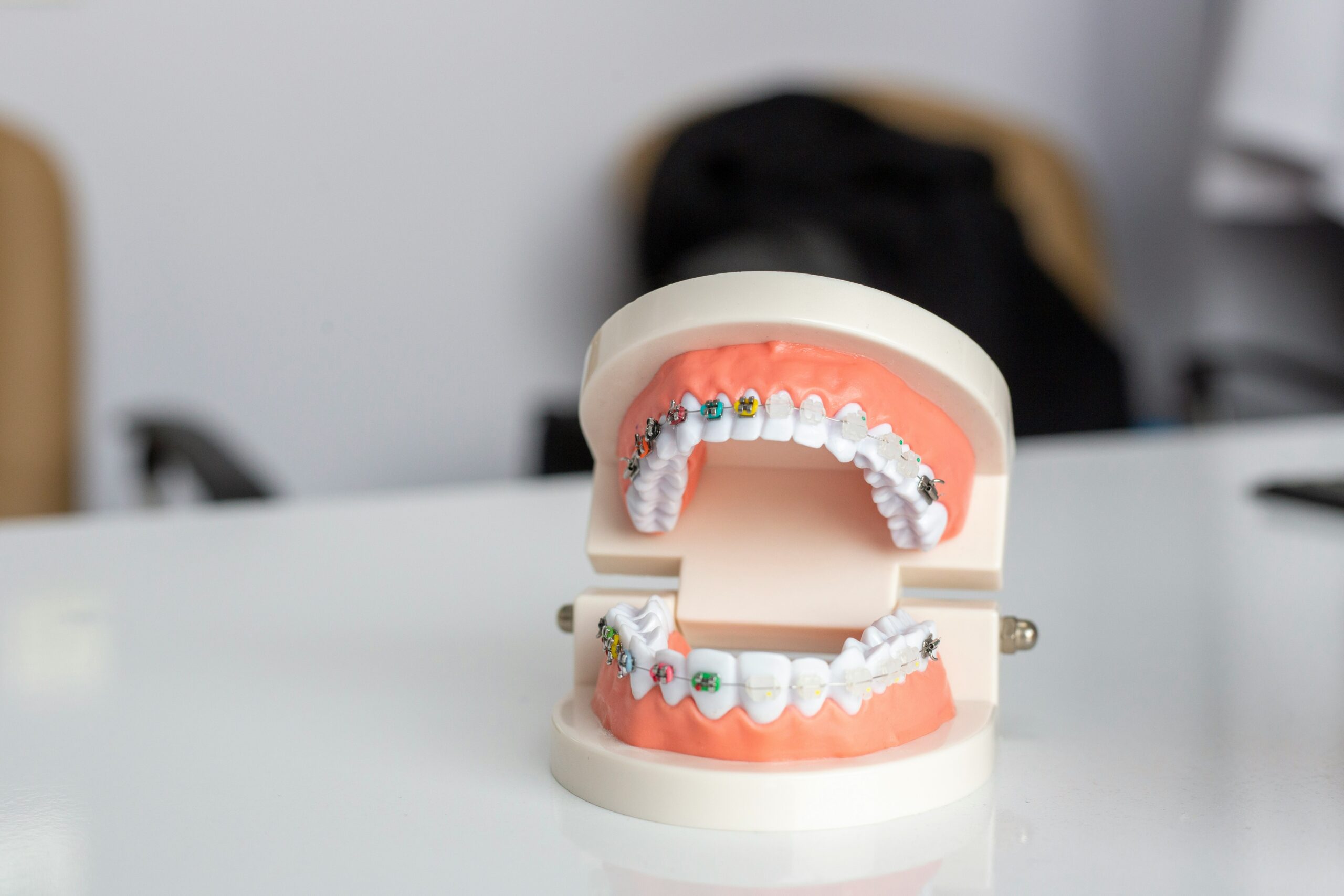 Common orthodontic misconceptions